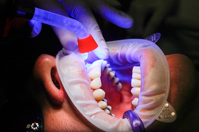 Usuwanie zębów pod narkozą – chirurg stomatolog Gdańsk